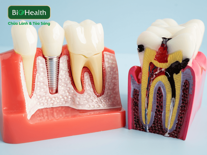Lợi ích vượt trội cho sức khỏe nướu và men răng - BioHealth