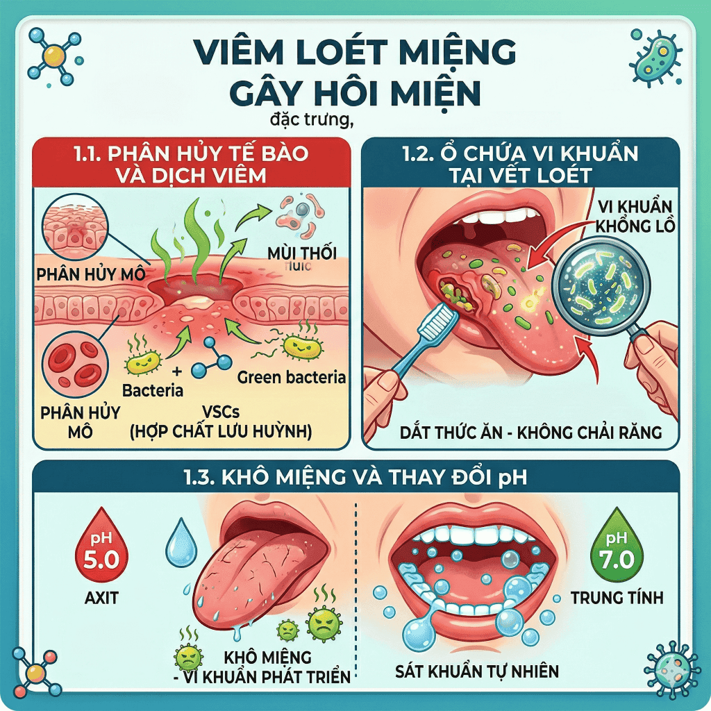 Tại sao viêm loét miệng lưỡi gây hôi miệng nồng nặc?