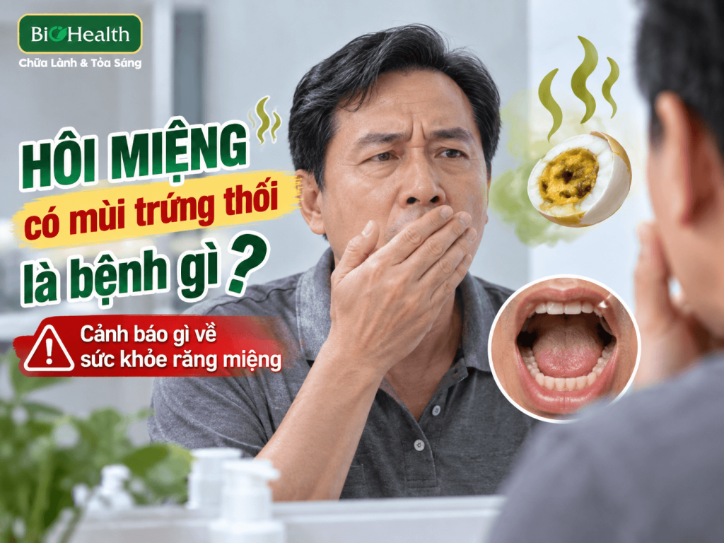 Hôi miệng có mùi trứng thối là bệnh gì? Cảnh báo gì về sức khỏe răng miệng