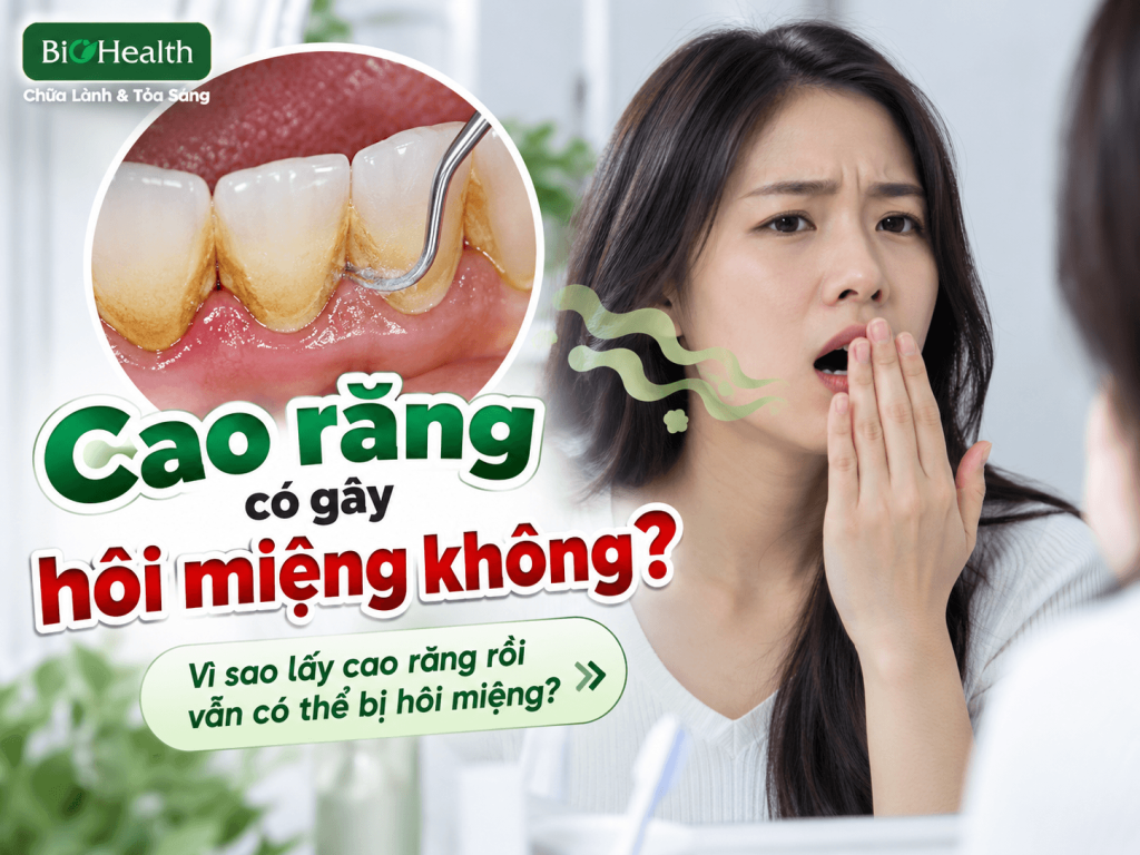 Cao răng có gây hôi miệng không? Vì sao lấy cao răng rồi vẫn có thể bị hôi miệng?